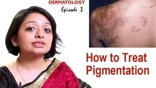 How to Treat Skin Pigmentation Episode 3 [upl. by Assil]