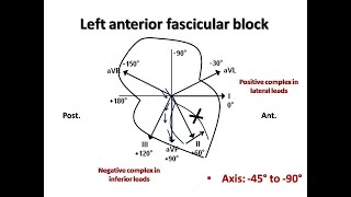 ECG course Fascicular Blocks Dr Sherif Altoukhy [upl. by Calandra]