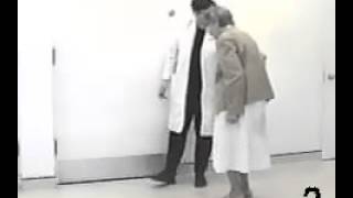 Parkinsonian shuffling gait [upl. by Ysor]