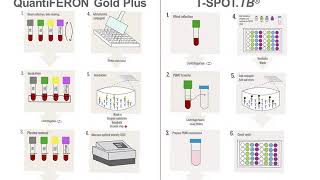 Interferon Gamma Release Assays IGRAs [upl. by Anele379]