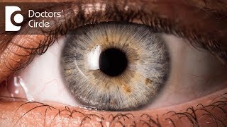 What is syneresis of the eye  Dr Elankumaran P [upl. by Ingrid]