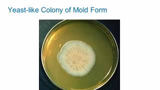 Dimorphic Fungi Sporothrichosis Hot Topic [upl. by Yatnuahc]