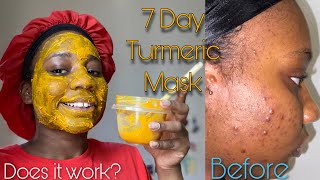 7 Day Turmeric Face Mask For Dark Spots  Honest Review [upl. by Teodor]