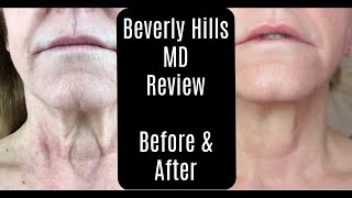 Beverly Hills MD Dermal Repair Complex—Lift and Firm Sculpting Cream—Before and After—AntiAging [upl. by Gee13]