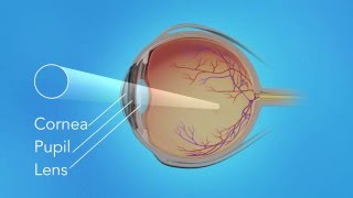 Healthy Retina Fundoscopy [upl. by Hsirt]