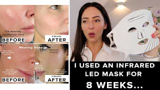 I used the CurrentBody LED Mask for 8 weeks amp this happened [upl. by Llerrit]