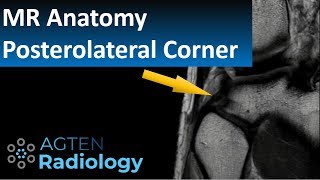 Ultimate Guide to MR Anatomy of the Posterolateral Corner in the Knee [upl. by Romola]