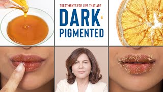 How To Treat DARK PIGMENTED Lips  Dermatologists Advice [upl. by Aloivaf]