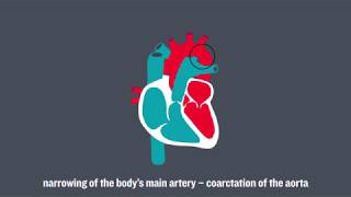 Congenital Heart Conditions [upl. by Doownyl]