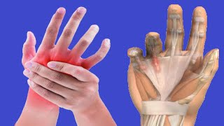 Stiff Fingers Causes and Treatments [upl. by Garin]