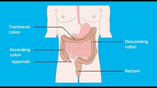 Why am I getting a colonoscopy at 29 [upl. by Nireil]