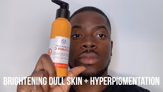 HOW I GOT RID OF DARK SPOTS BRIGHTEN DULL SKIN  HYPERPIGMENTATION [upl. by Odrareg]