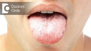 Tonsillitis symptoms  Signs and Symptoms of Tonsillitis Tonsillitis treatment Health and wellness [upl. by Atiral114]