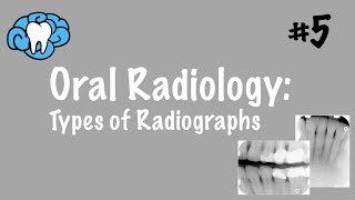 Oral Radiology  Types of Radiographs  INBDE ADAT [upl. by Oemor]