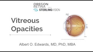 Part 1 Vitreous Anatomy [upl. by Crawford479]