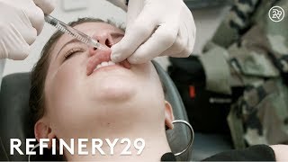 Our Botox amp Juvederm Lip Injections Experience  Try This Challenge  Refinery29 [upl. by Edurtreg884]