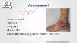 Treatment of Idiopathic Thrombocytopenic Purpura ITP [upl. by Idisahc949]