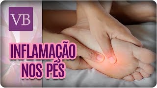 Neuroma de Morton Inflamação nos Pés  Você Bonita 270318 [upl. by Pence]