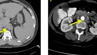 Introduction to Radiology Conventional Radiography [upl. by Lesna]