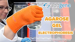 Agarose Gel Electrophoresis [upl. by Aikenahs]