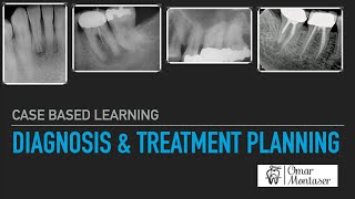 Dental treatment in Kokkinos clinic [upl. by Fari]