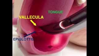 Incorrect and Corrected Endotrachial Intubation [upl. by Bourke]