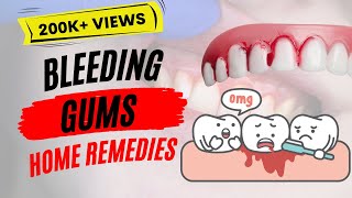 NOVA Pediatric Dentistry amp Orthodontics  How to Take XRays [upl. by Eittah280]