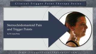 Sternocleidomastoid SCM Pain and Trigger Points [upl. by Zanahs]