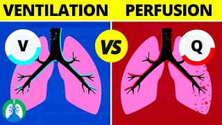 VentilationPerfusion VQ Ratio  Quick Medical Overview [upl. by Mendoza]