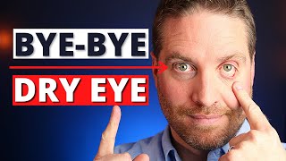 How To Get Rid Of Dry Eyes  4 Advanced Home Treatments [upl. by Applegate]