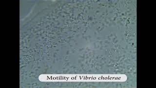 Motility of Vibrio cholerae [upl. by Rooney]