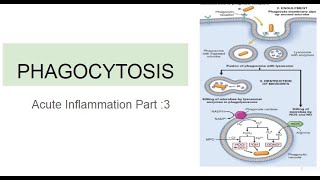 Phagocytosis Acute Inflammation Part 3 [upl. by Sirrad444]