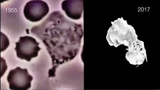 See White Blood Cells Move in 3D Imaging [upl. by Allmon977]