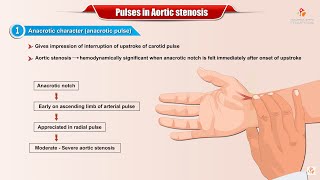 carotid artery pulse VS jugular venous pressure [upl. by Marian]