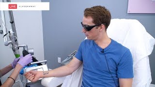 Laser Tattoo Removal LIVE SESSION at LaserAway 🔴 [upl. by Ysor]