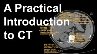 A Practical Introduction to CT [upl. by Ariajaj]