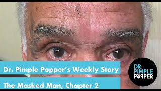 Dr Pimple Poppers Weekly Story Time The Masked Man Chapter 2 [upl. by Inan]