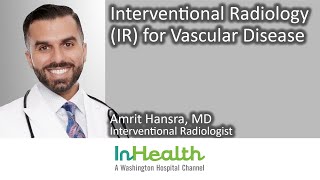 Interventional Radiology IR for Vascular Disease [upl. by Keyte]