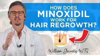 Minoxidil How Does Minoxidil Work For Hair Regrowth Results  Trichologist William Gaunitz [upl. by Paddy]