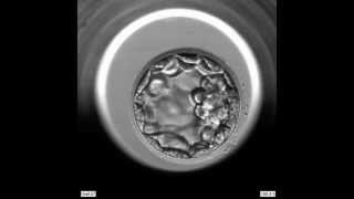 EmbryoScope Embryo Development  Blastocyst [upl. by Mich]