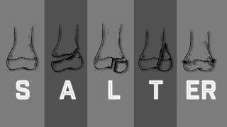 Salter Harris Fracture Classification  MEDZCOOL [upl. by Ecirtael127]