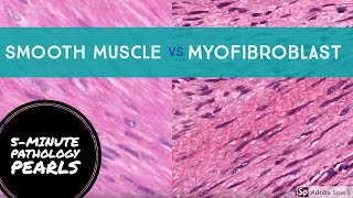 Myofibroblasts vs Smooth Muscle Made Easy 5Minute Pathology Pearls [upl. by Derwin280]