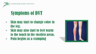 DVT Deep Vein Thrombosis Prevention Exercises  Ask Doctor Jo [upl. by Ahsitaf]