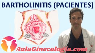 PATOLOGÍA de la GLÁNDULA DE BARTHOLINO BARTHOLINITIS QUISTE ABSCESO  Ginecología y Obstetricia [upl. by Seamus641]