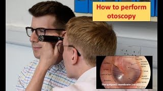 How to perform Otoscopy Ear Exam [upl. by Cha]