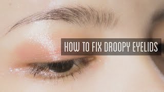 How to Fix Droopy Eyelids [upl. by Anihc]