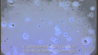 How to Prepare a Wet Mount  MCCC Microbiology [upl. by Gayler]