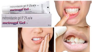 Metrogyl DG Gel Forte Use to teeth bacterial infection [upl. by Ahsinod441]