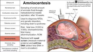 Progression of Chorioamnionitis and its Effects on the Fetal Brain [upl. by Machutte]