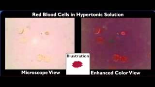 hemolysis crenation [upl. by Nalniuq]